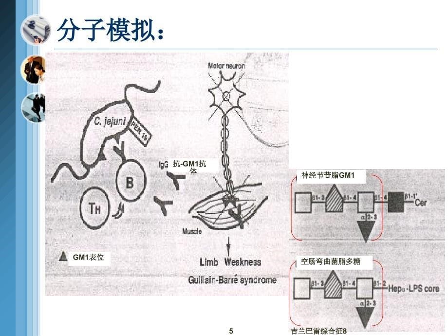 吉兰巴雷综合征8课件_第5页