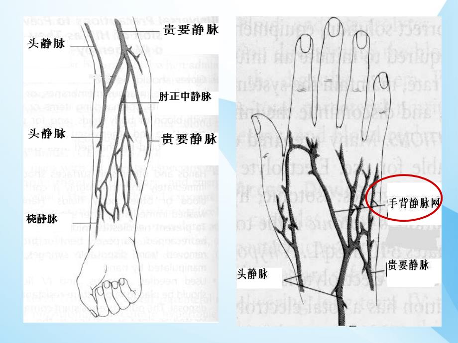 小儿头皮静脉穿刺技巧及特点_第4页