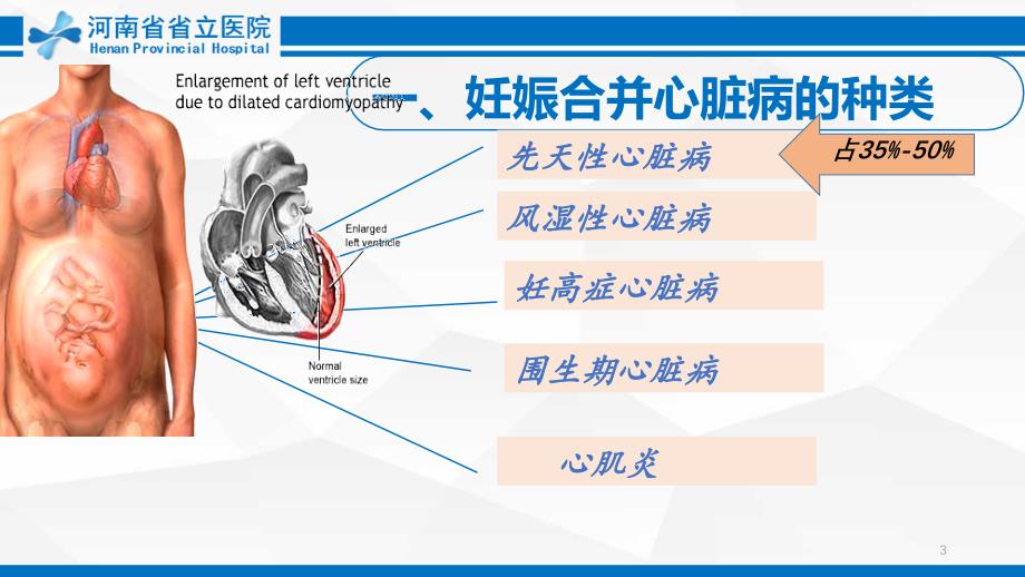 妊娠合并心脏病PPT参考幻灯片_第3页