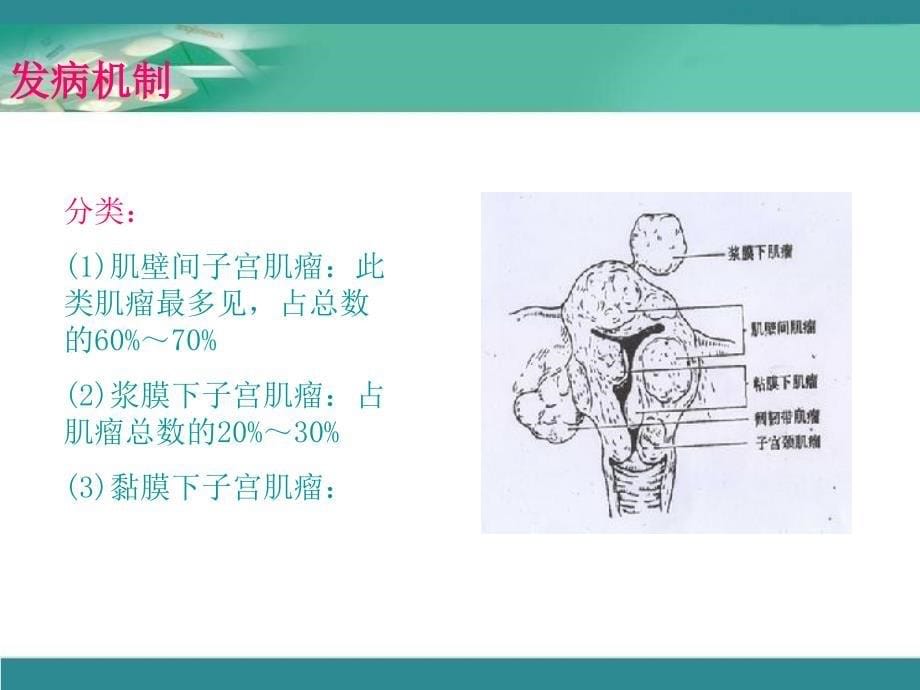 妊娠合并子宫肌瘤_第5页