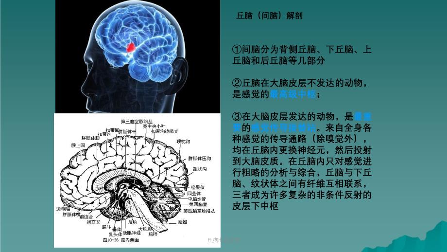 丘脑出血护理课件_第3页