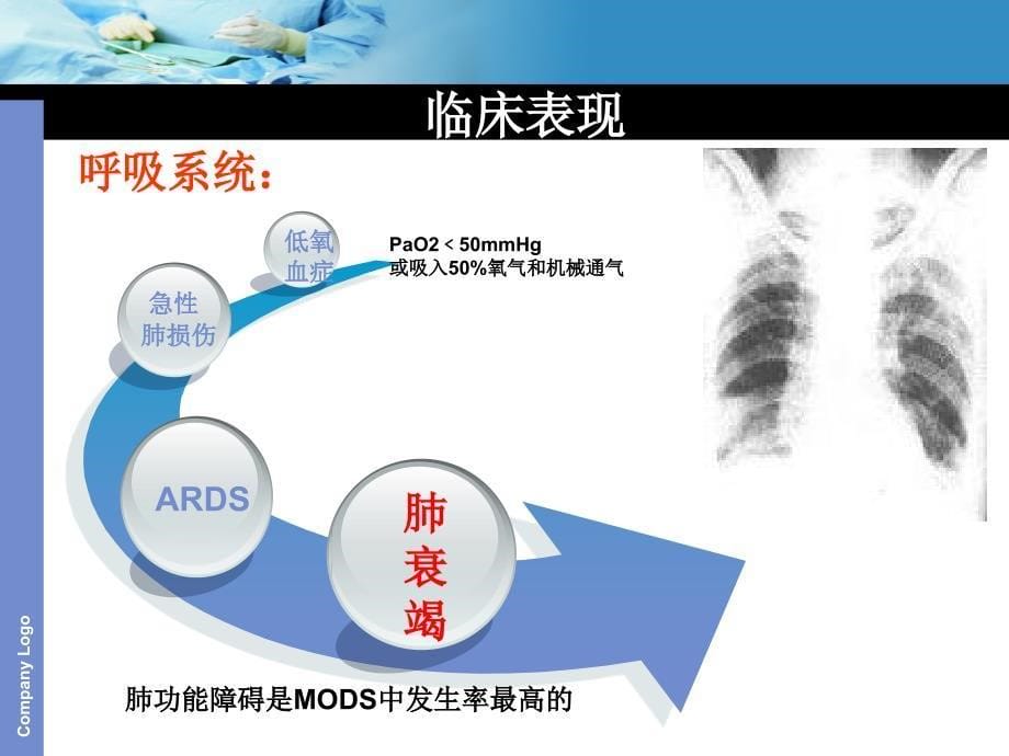 多脏器功能衰竭患.ppt_第5页