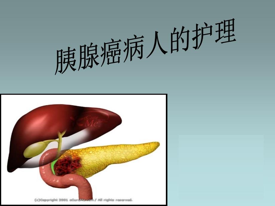 胰腺癌病人的护理ppt课件_第1页