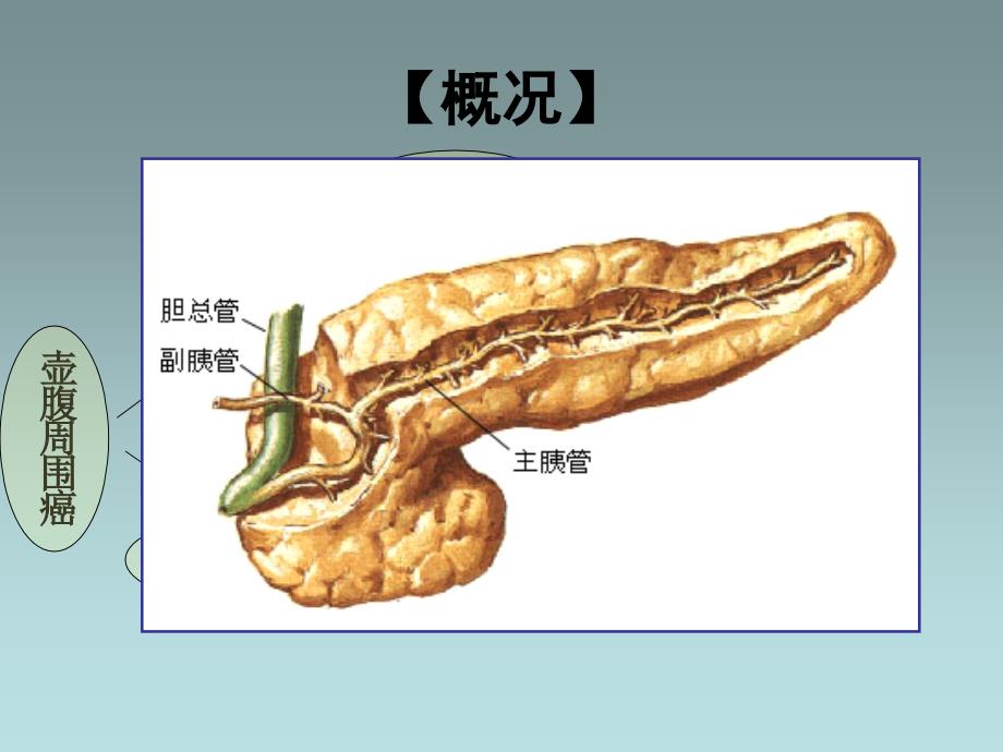 胰腺癌病人的护理ppt课件_第4页