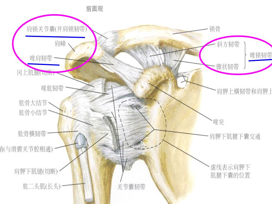 肩锁关节脱位治疗.ppt_第4页