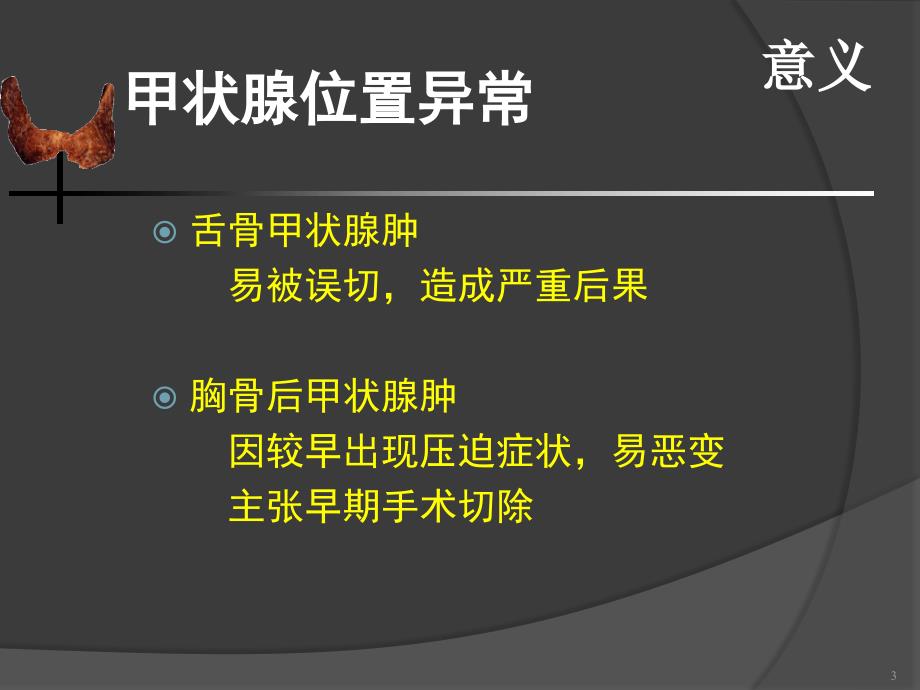 甲状腺疾病PPT课件_第3页