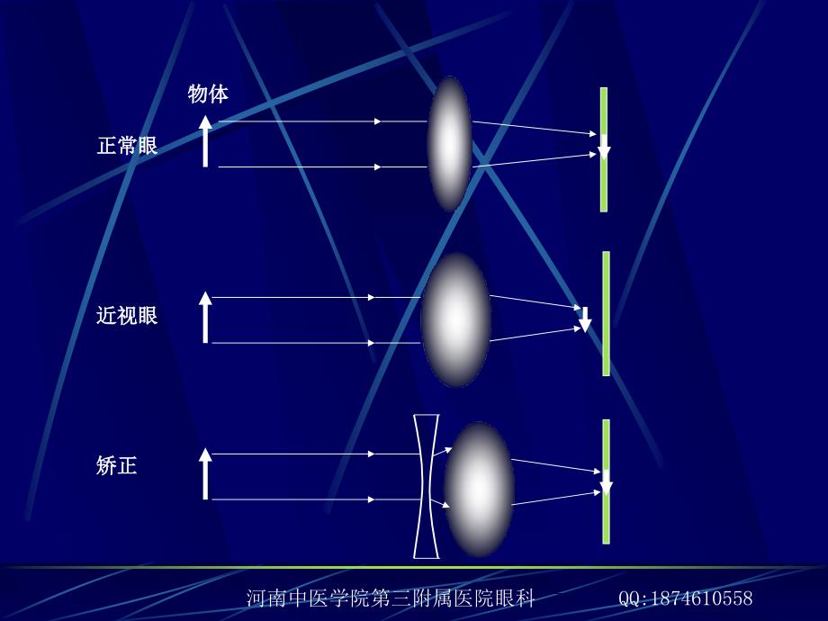 第四章 预防近视眼-冯磊_第4页