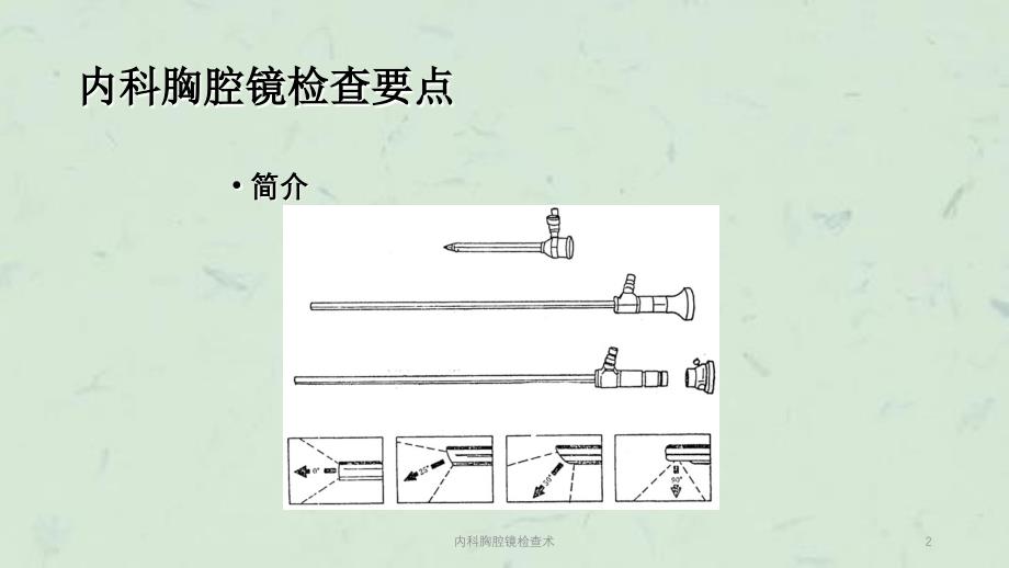 内科胸腔镜检查术课件_第2页