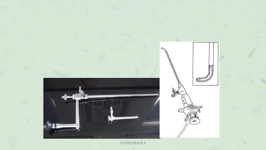 内科胸腔镜检查术课件_第5页