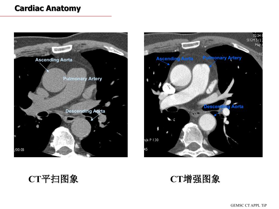 CT心脏断面解剖PPT课件_第3页