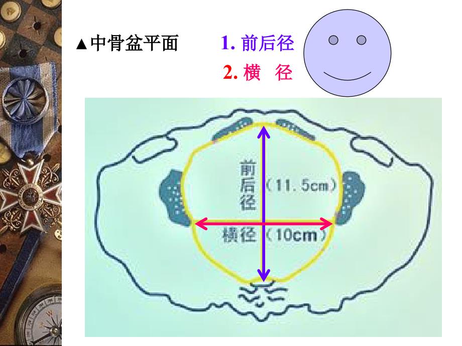 妇产科课件骨盆内外测量_第4页