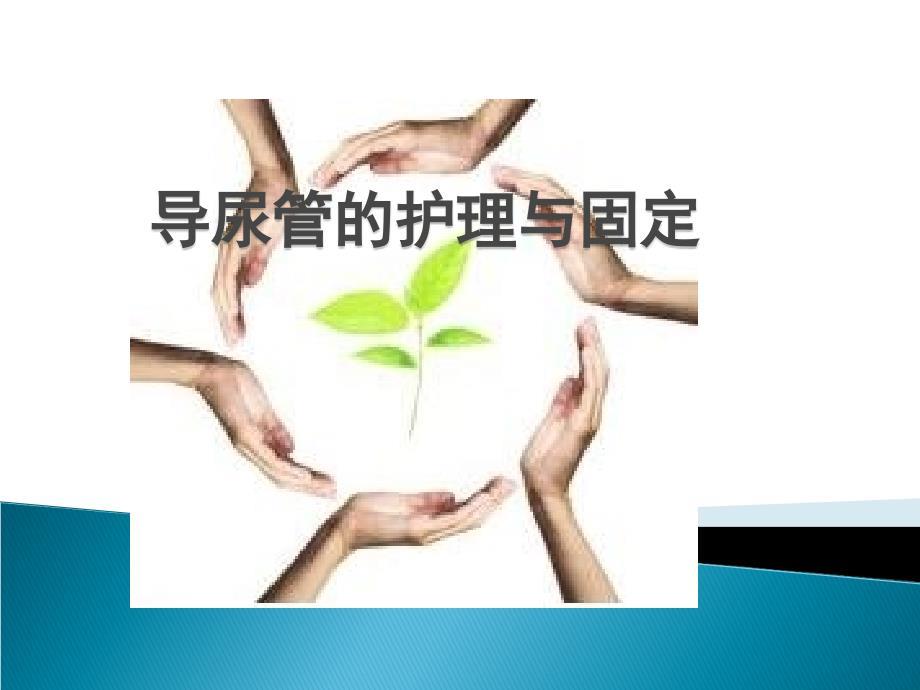 导尿管的护理及固定50035