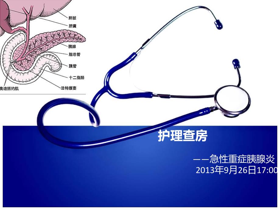 急性重症胰腺炎的护理查房_第1页