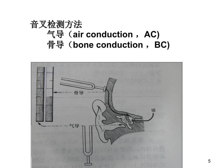 听力检查法PPT参考幻灯片_第5页