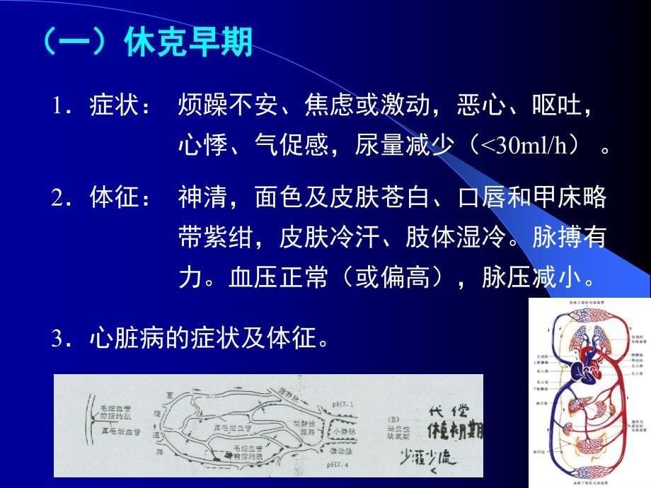 心源性休克课件1h_第5页