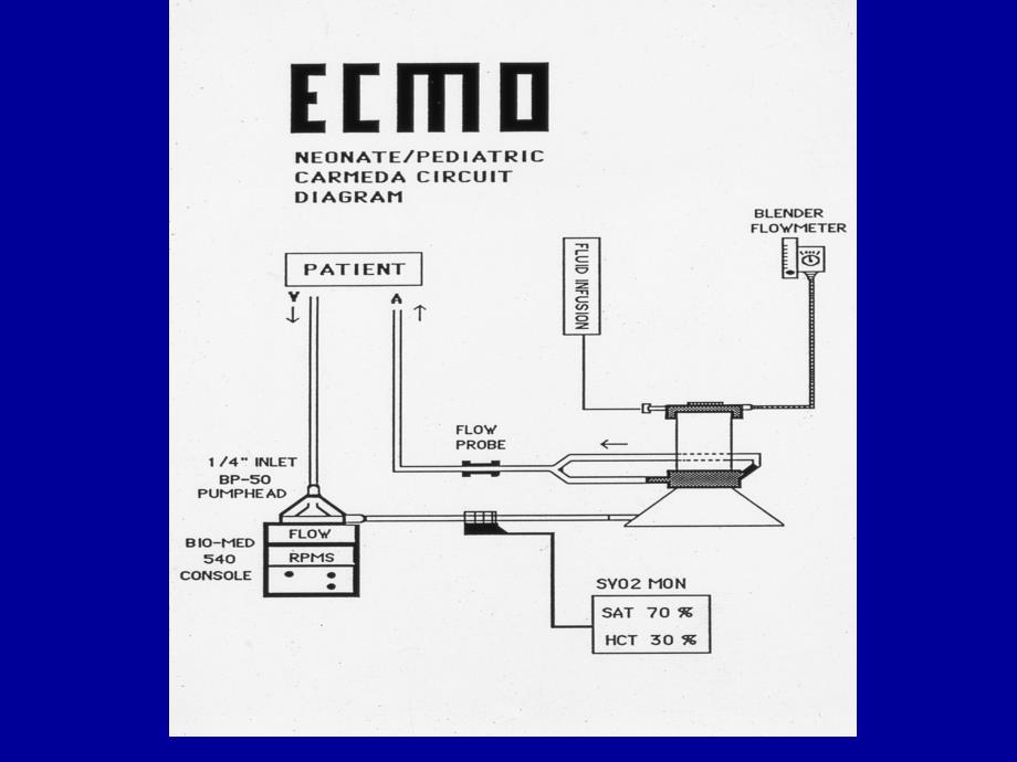 ECMO OXYGENATORSUniversity of Minnesota Medial …：ECMO氧明尼苏达大学医学…_第2页