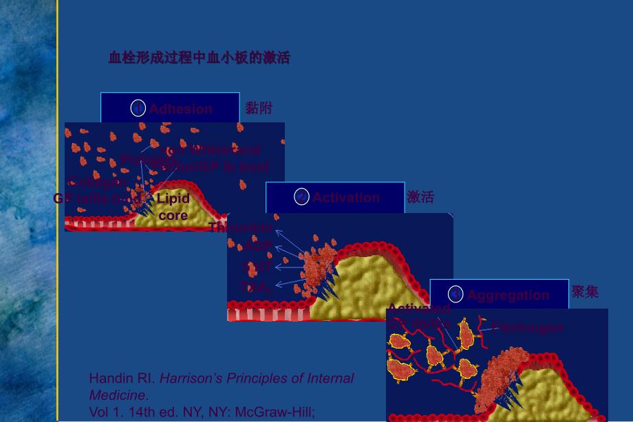 欣维宁盐酸替罗非班在急性冠脉综合症的临床应用床应用ppt课件_第3页