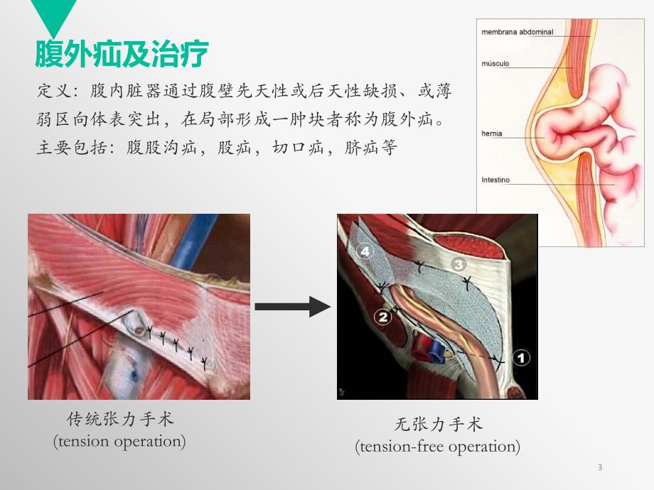 生物补片及相关应用进展ppt课件_第3页