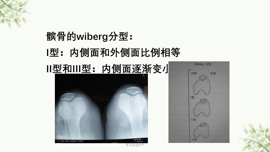 髌骨置换的适应症课件_第2页