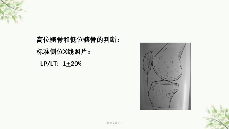 髌骨置换的适应症课件_第3页