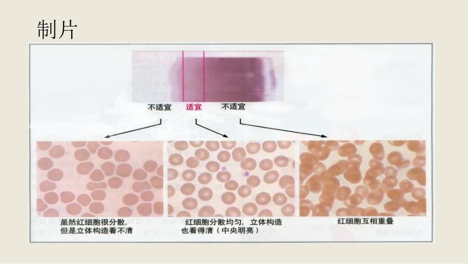 外周血细胞形态PPT课件_第3页