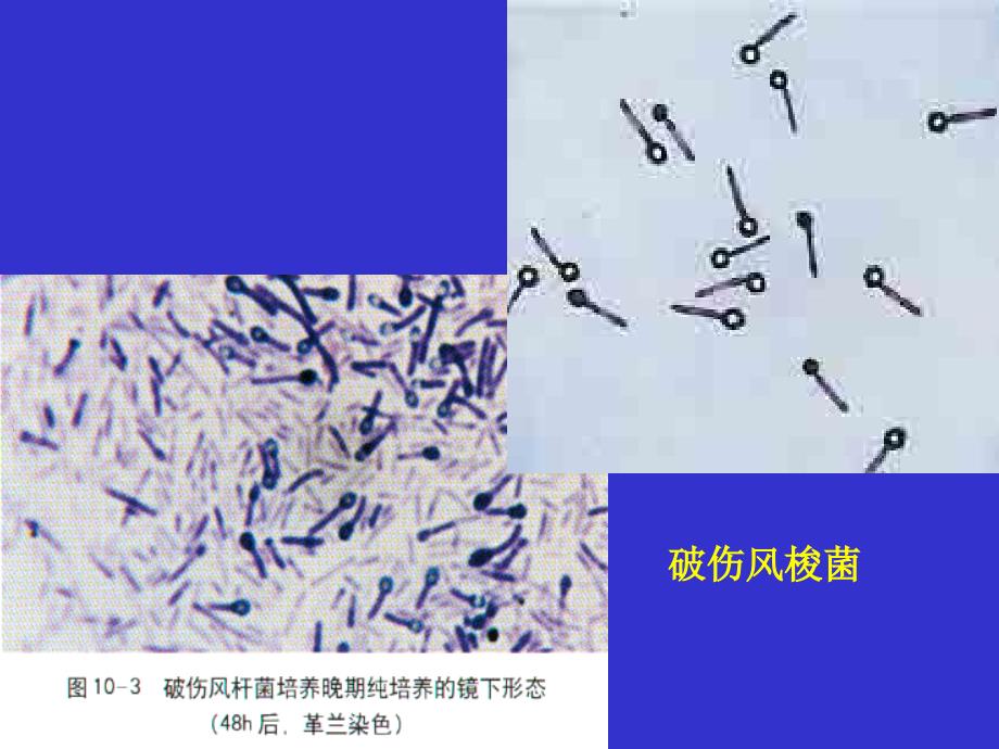 微生物第20章梭菌属_第4页