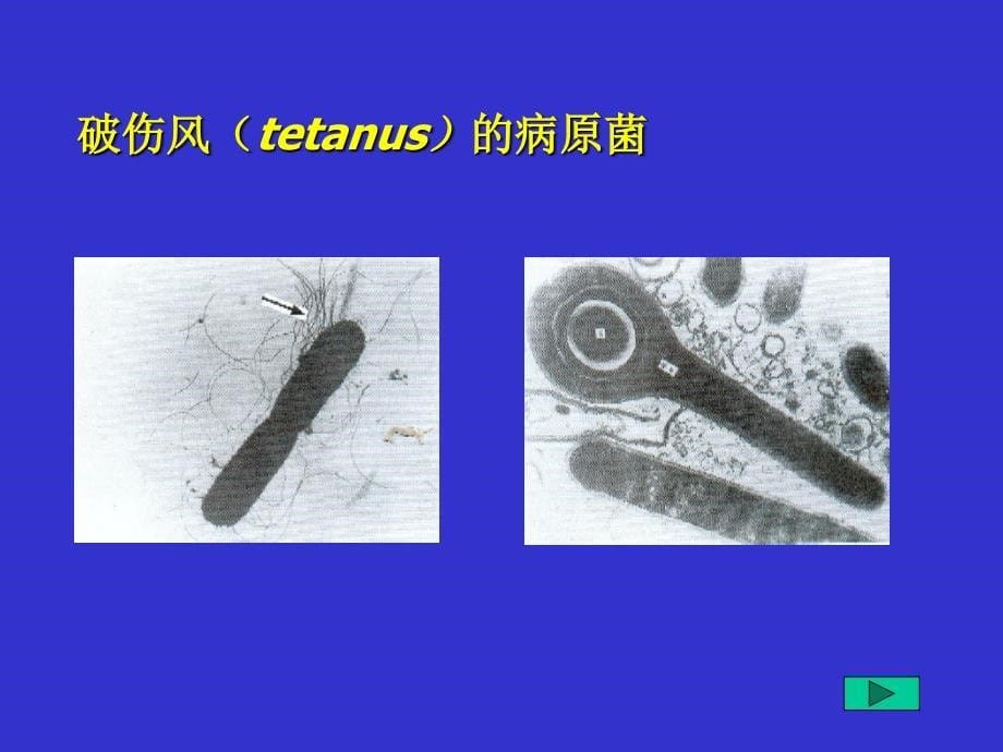 微生物第20章梭菌属_第5页