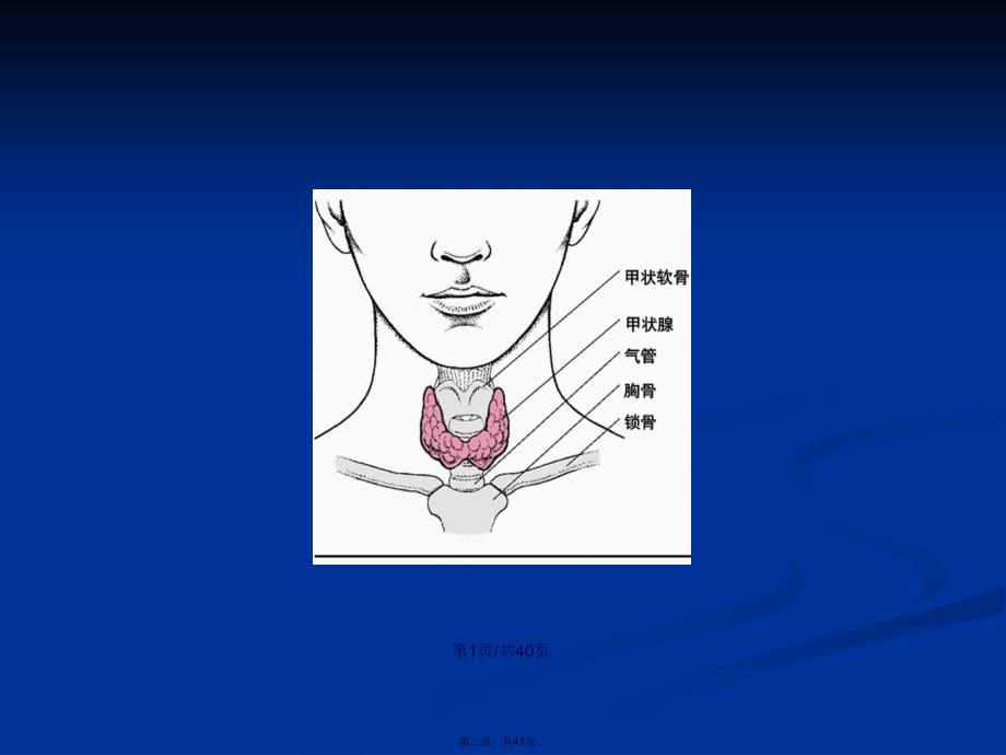 甲状腺腔镜手术学习教案_第2页