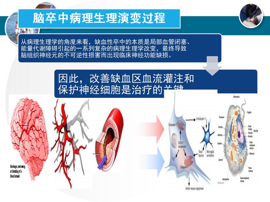 急性脑梗塞的病理生理与治策略_第3页