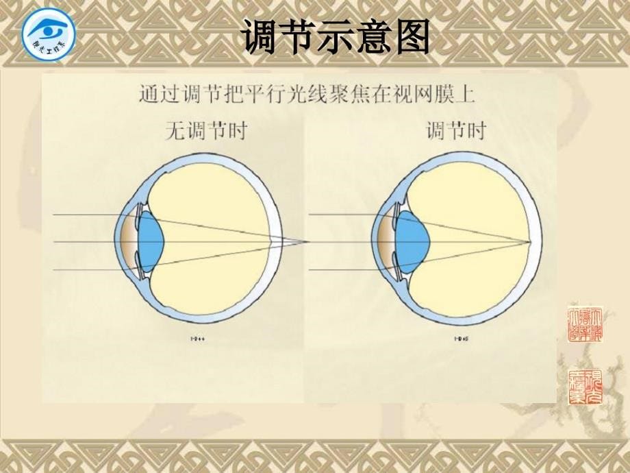 非斜视性双眼视异常_第5页