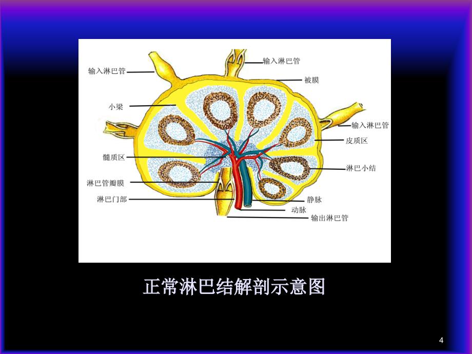 淋巴结超声ppt课件_第4页