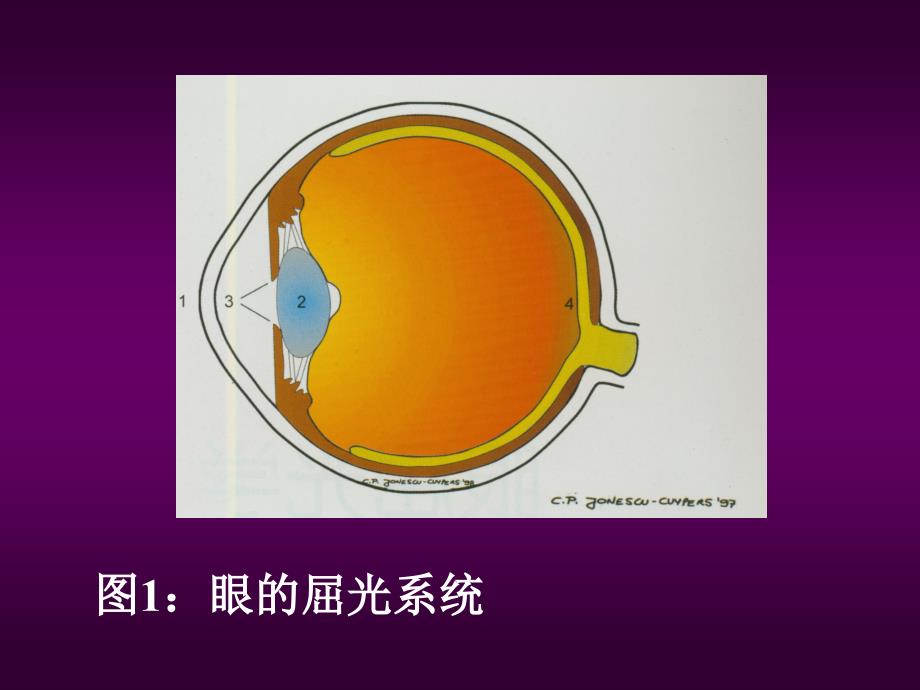 眼科学教学课件：眼视光学眼肌与全身病_第3页