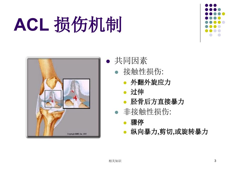 膝关节前交叉韧带损伤诊断与治疗专业研究_第3页