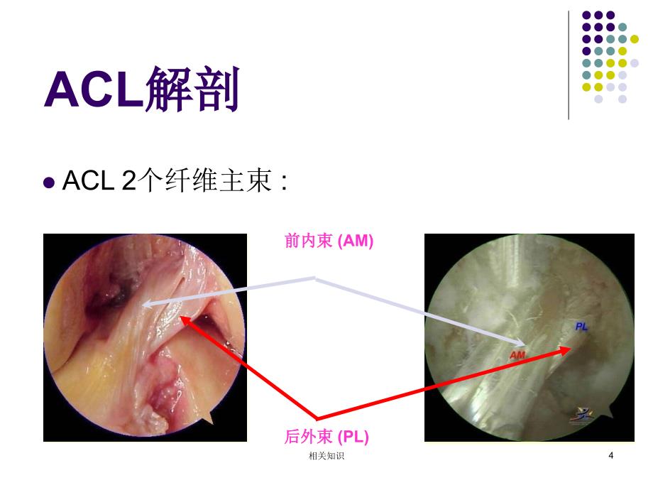 膝关节前交叉韧带损伤诊断与治疗专业研究_第4页