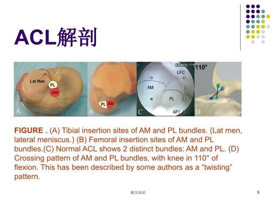 膝关节前交叉韧带损伤诊断与治疗专业研究_第5页