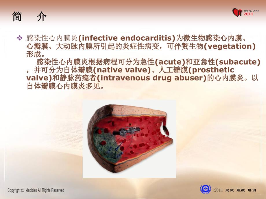 感染性心内膜炎诊治现状_第2页