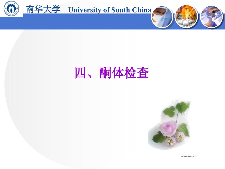 11.第五章 第二节尿液化学检查2_第2页