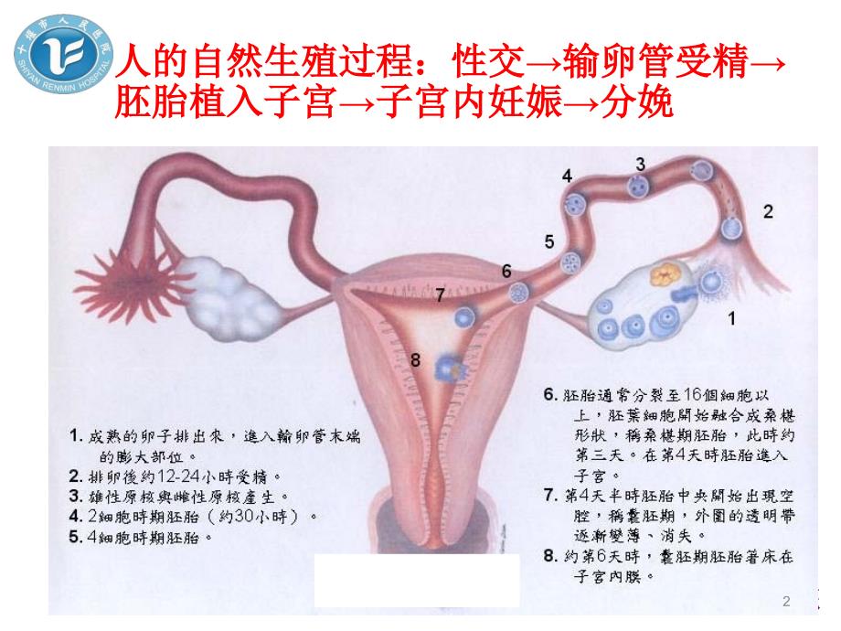 试管婴儿知识宣讲PPT参考幻灯片_第2页