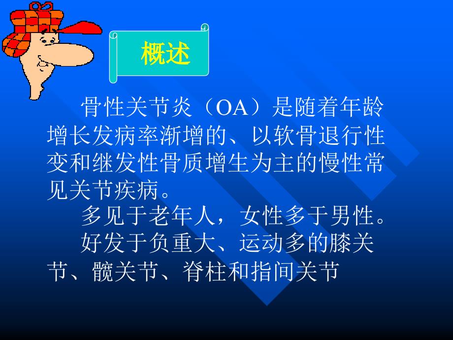 骨性关节炎ppt幻灯片_第2页