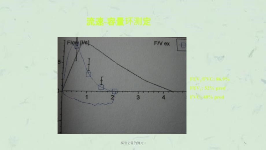 膈肌功能的测定0课件_第5页