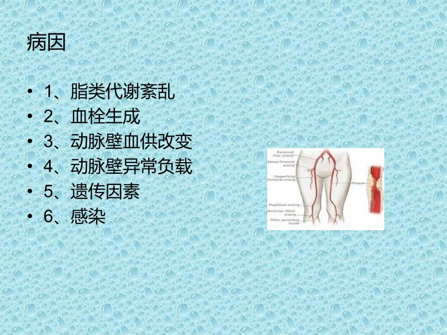 动脉硬化闭塞症护理ppt课件_第4页