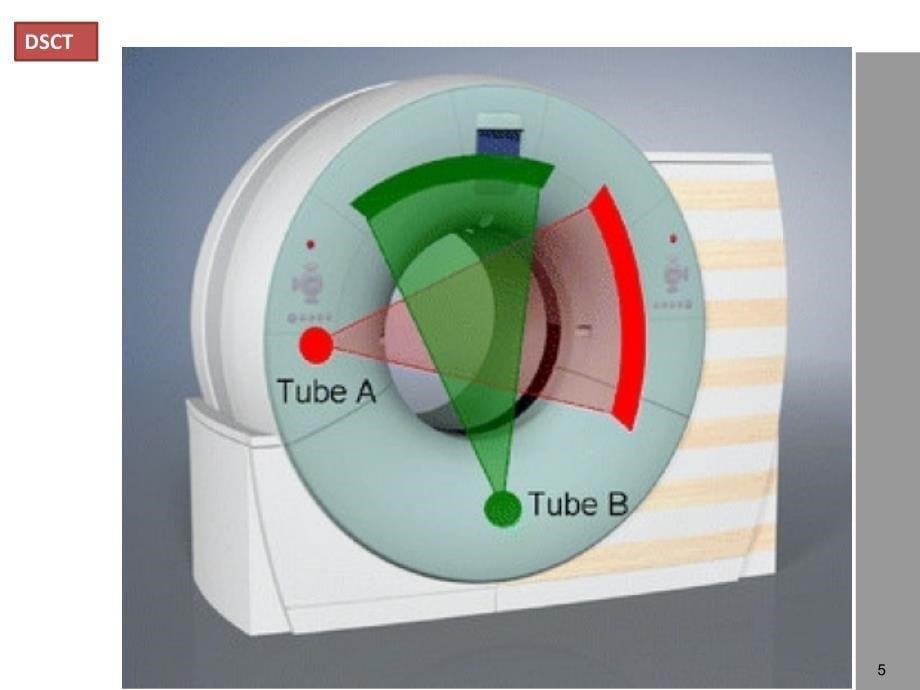 CT新技术介绍ppt课件_第5页