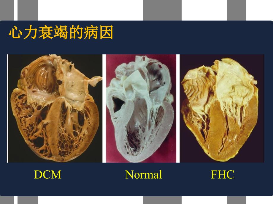 心力衰竭护理新进展_第4页