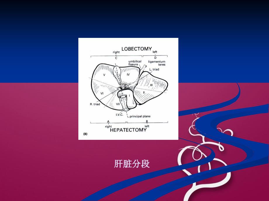 《临床肝切除的主要并发症及防治》课件_第3页