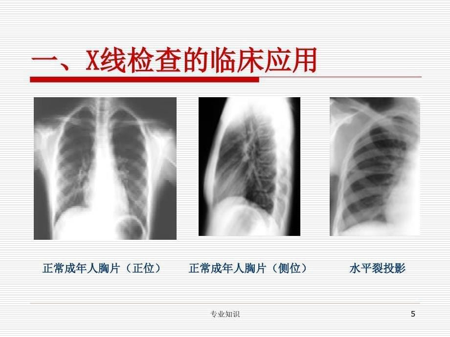 影像学检查实验专业材料_第5页