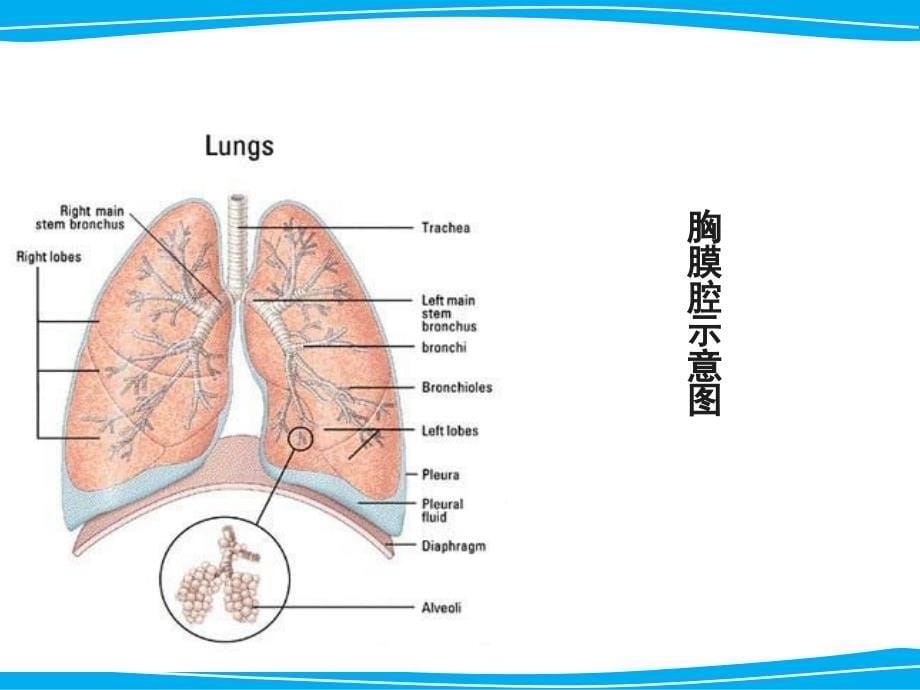 胸腔闭式引流术及护理._第5页