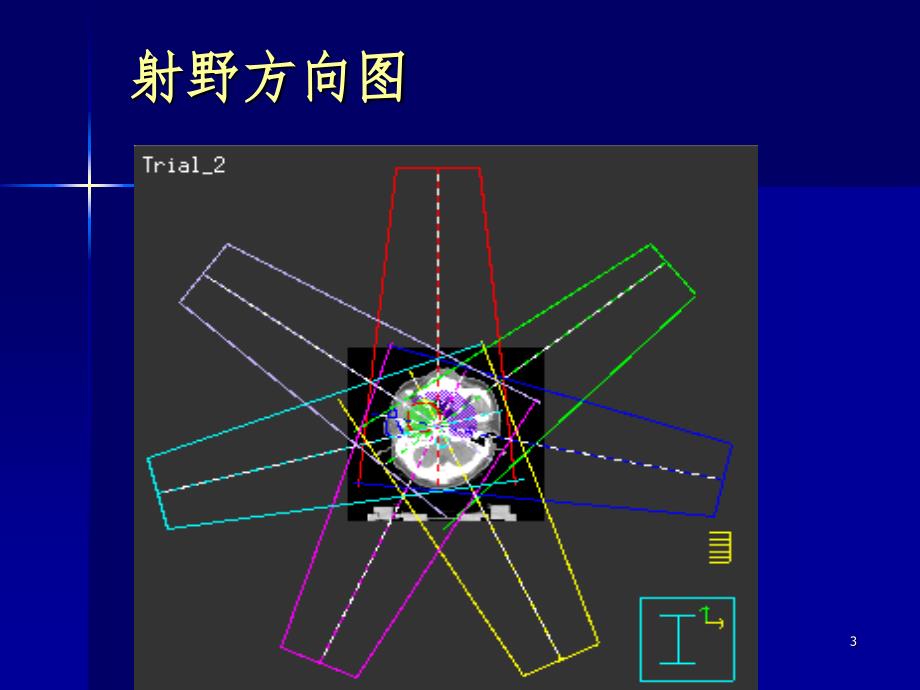 三维适形调强放疗计划的设计PPT精品文档_第3页