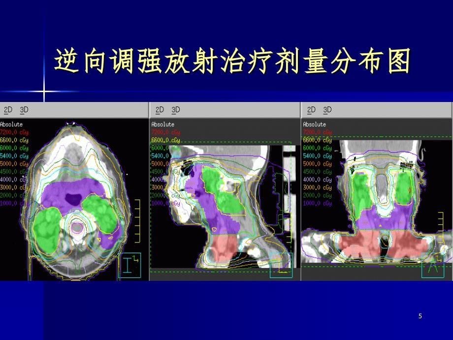 三维适形调强放疗计划的设计PPT精品文档_第5页