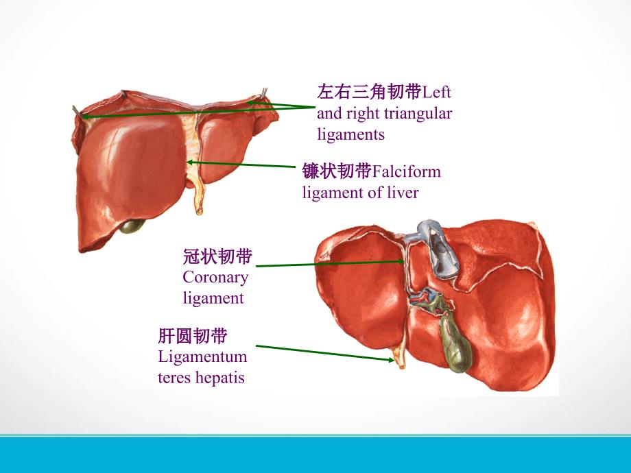 肝脏镰状韧带旁假病灶的CT表现课件.ppt_第4页