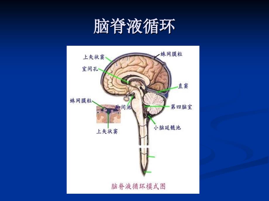 脑积水.ppt_第3页